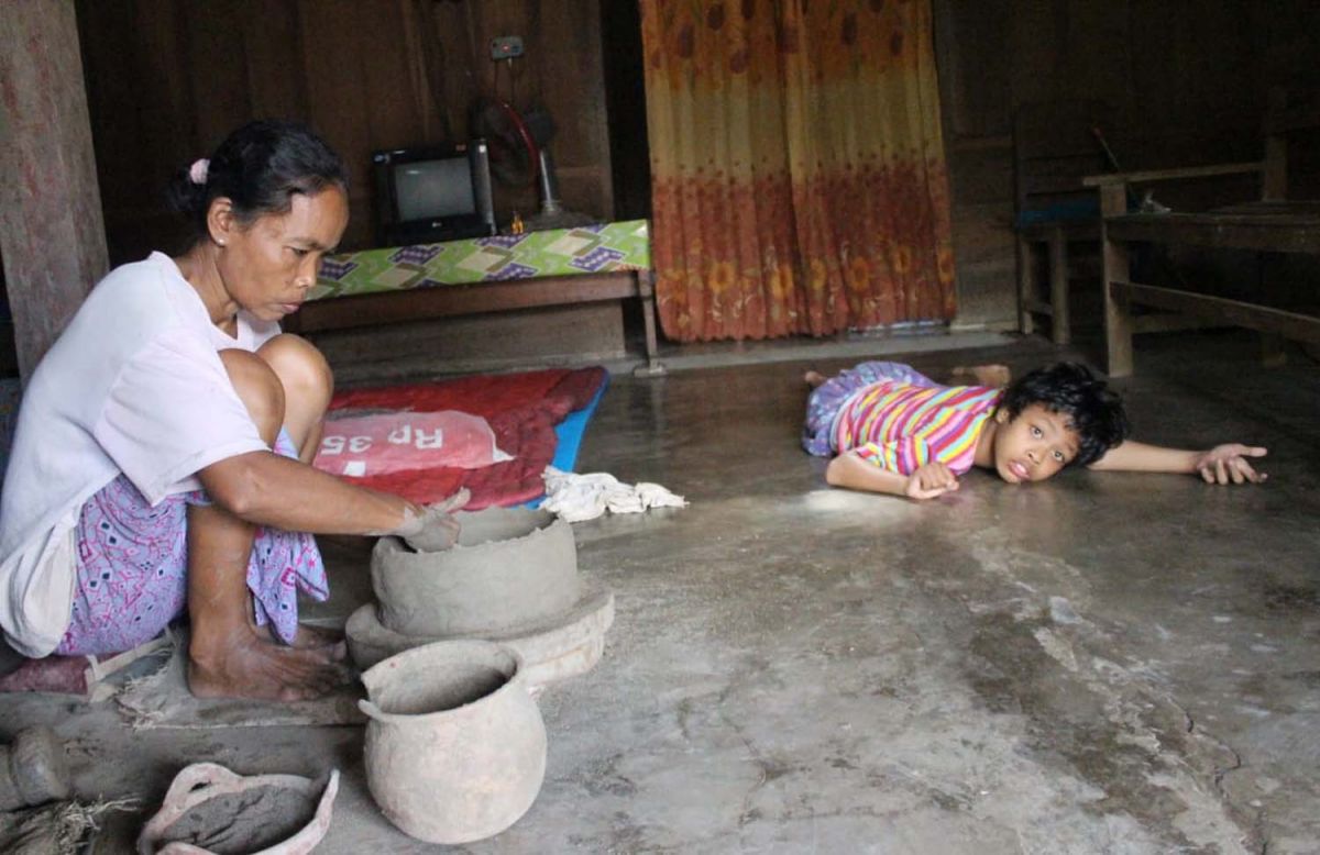 Tolong! Anak 11 Tahun Penderita Gangguan Syaraf Otak di Jombang Butuh Bantuan