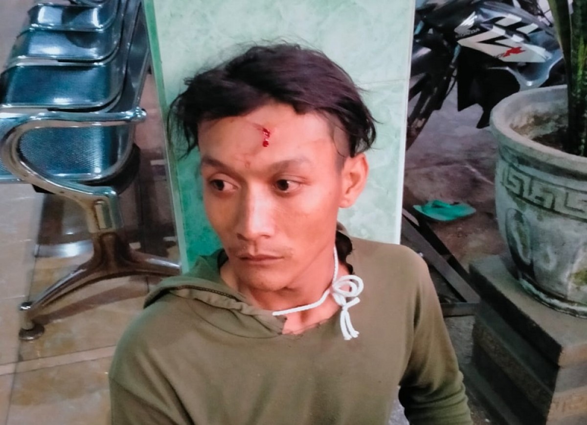 Korban luka ringan dibagian dahi akibat dihajar oknum pesilat. (Foto: Elok Aprianto/jatimnow.com)