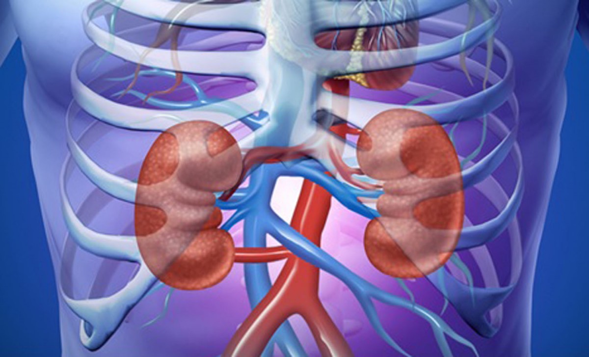 Ilustrasi gagal ginjal