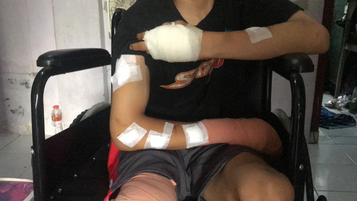 Kondisi korban saat ditemui di rumahnya. (foto: Zainul Fajar/jatimnow.com)