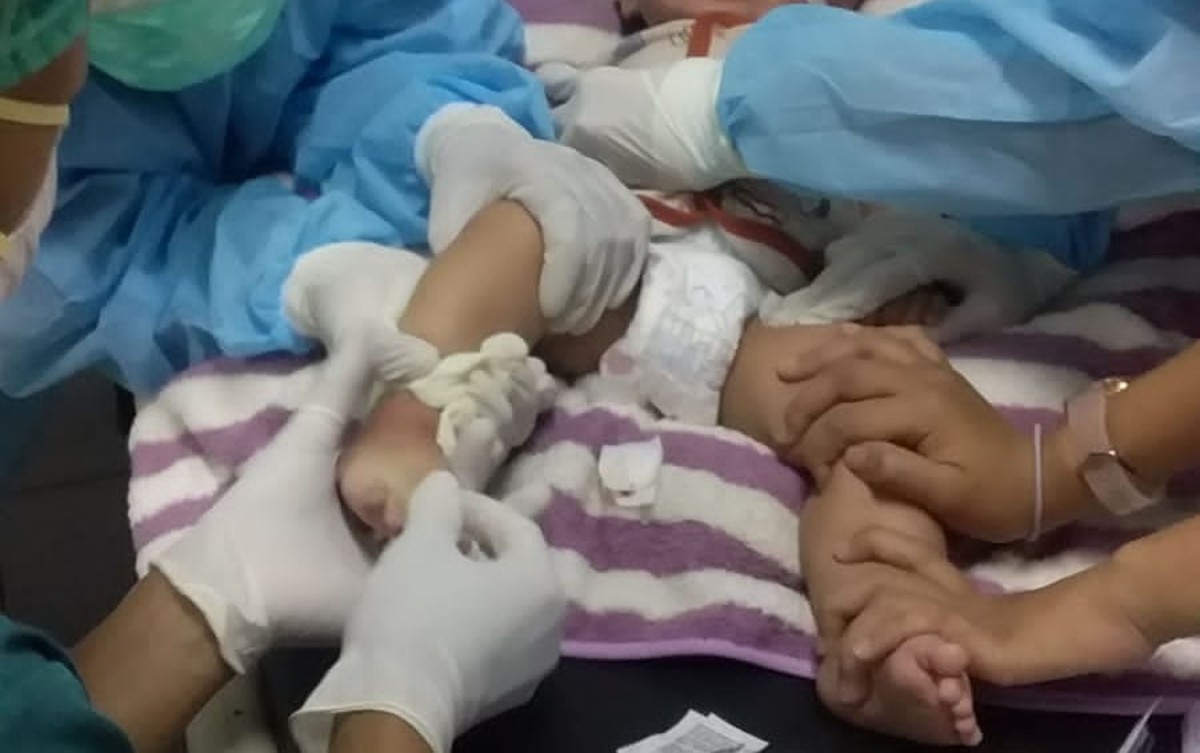 Pilu Keluarga Bayi Hidrosefalus di Lamongan: Tekanan Mental, Kesulitan Ekonomi