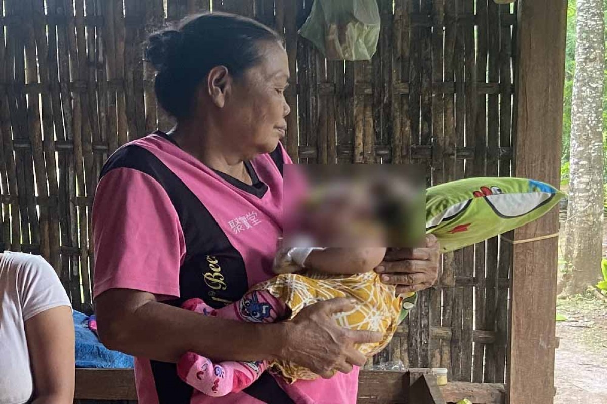 Tiara, bayi tanpa batok kepala. (Foto: Ahmad Fauzani/jatimnow.com)