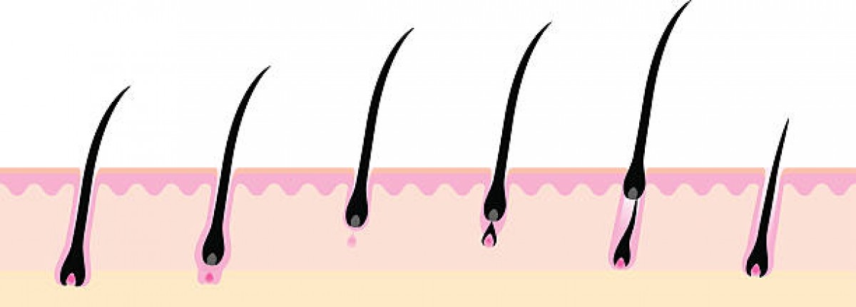 (foto: bodyhair illustration)