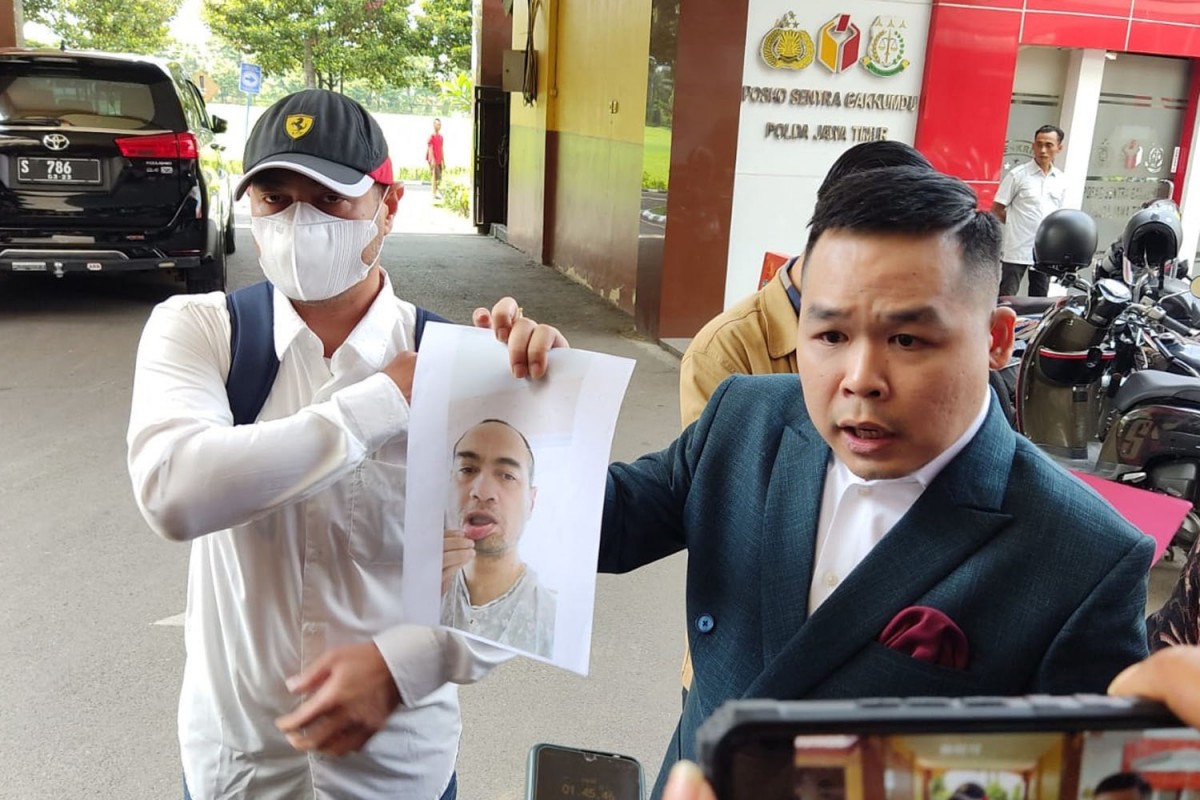 Ferry Irawan Curhat Dicakar Venna Melinda hingga Bibirnya Berdarah