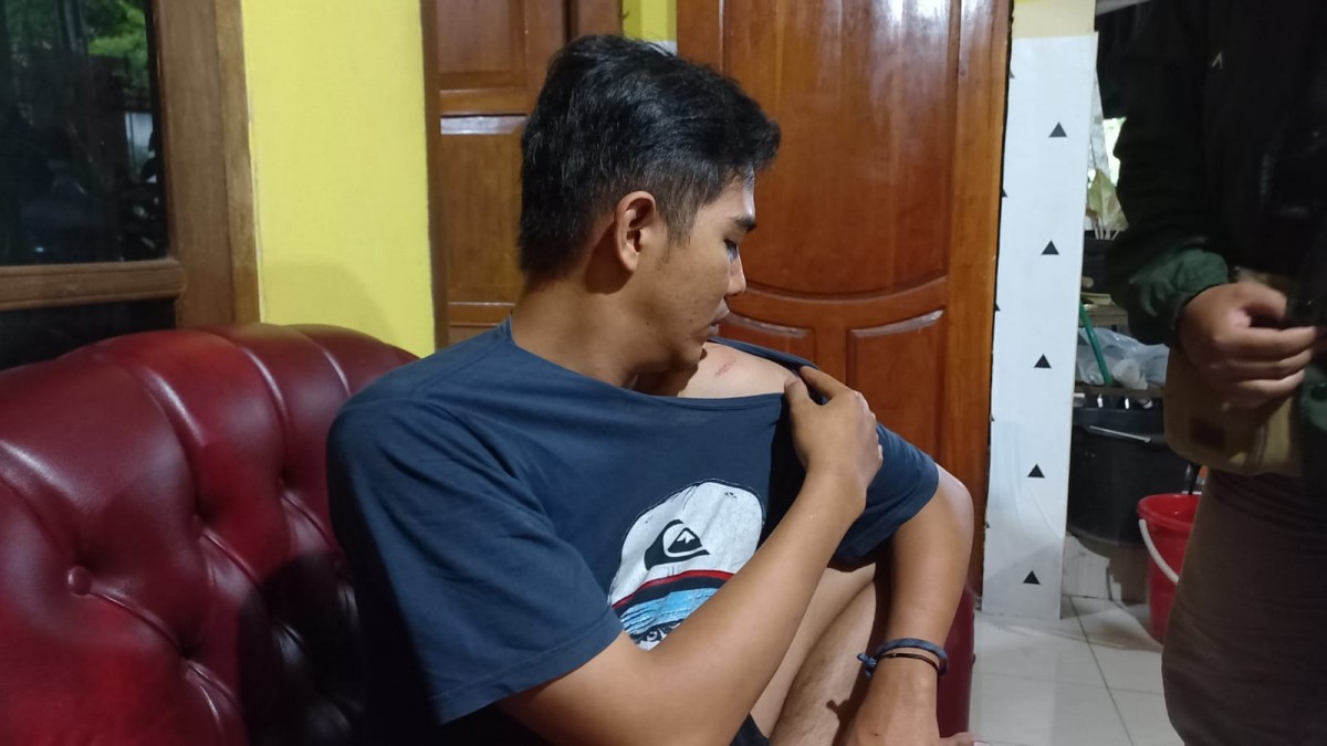 Korban menunjukkan luka-luka setelah dikeroyok gerombolan bermotor yang diduga dilakukan pendekar. (foto: Zainul Fajar/jatimnow.com)