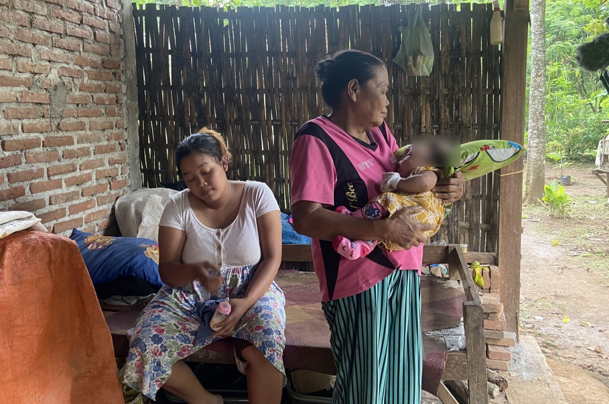 Tiara, Bayi Tanpa Batok Kepala asal Ponorogo Dirujuk ke RSU dr Soetomo Surabaya