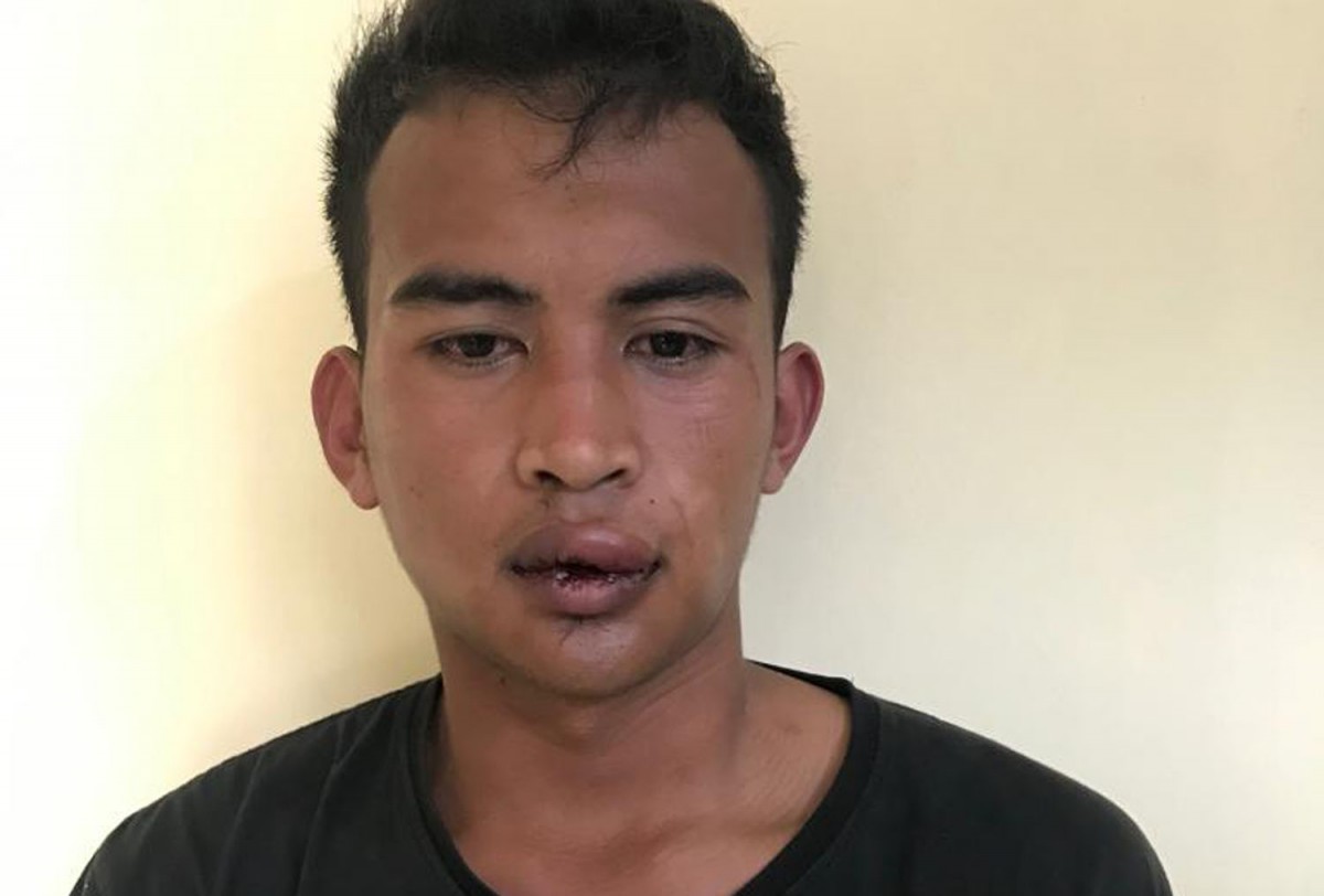 Jadi Buronan Dua Tahun, Begal Pikap Bermuatan Ayam di Pasuruan Disergap Polisi