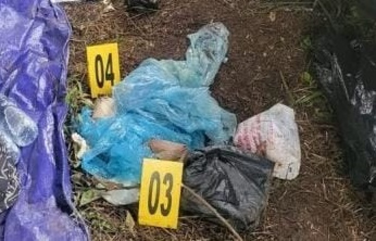 Sampel makanan yang diambil tim medis. (Foto: Polres Malang)