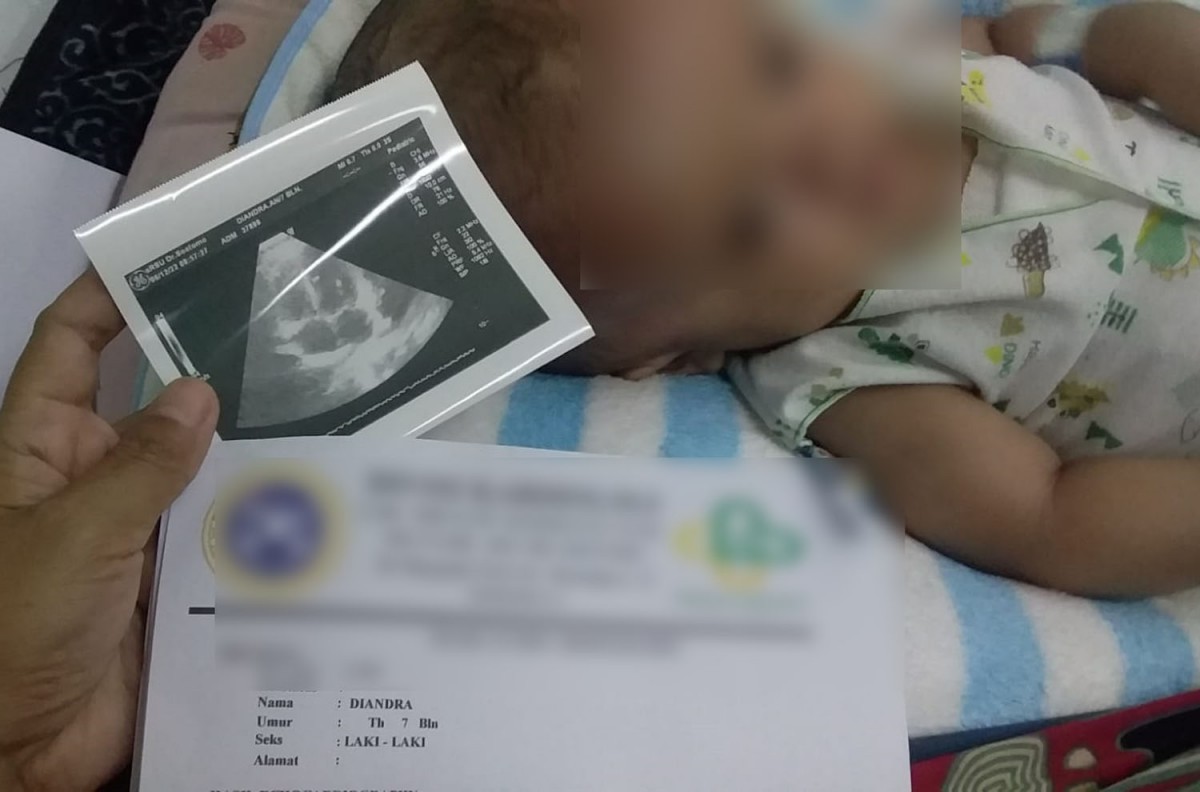 Diandra Putra Nur Ardianzah, bayi pengidap hidrosefalus asal Lamongan (Foto: Adyad Ammy Iffansah/jatimnow.com)