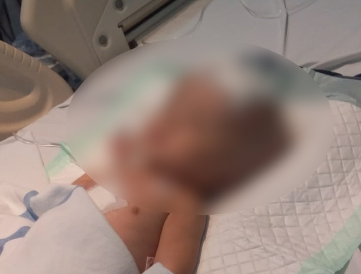 Kondisi bayi pengidap hidrosefalus asal Kecamatan Brondong, Kabupaten Lamongan. (foto : Adyad Ammy Iffansah/jatimnow.com)