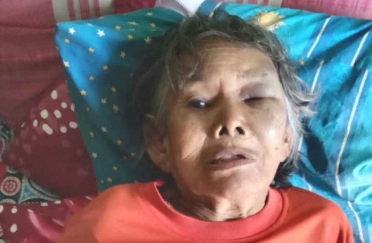 Hilang saat Cari Tanaman Pakis, Nenek Ditemukan Tersesat di Hutan