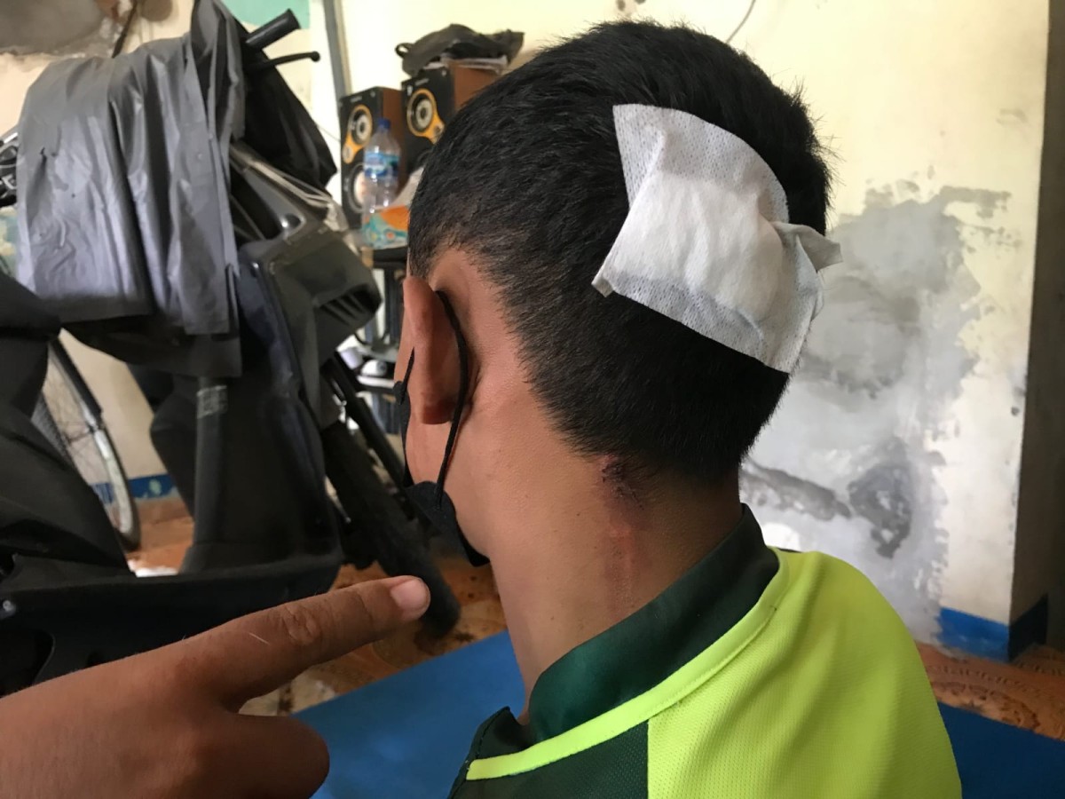 Kepala korban harus dijahit akibat pengeroyokan gangster. (Foto: Achmad Supriyadi/jatimnow.com)