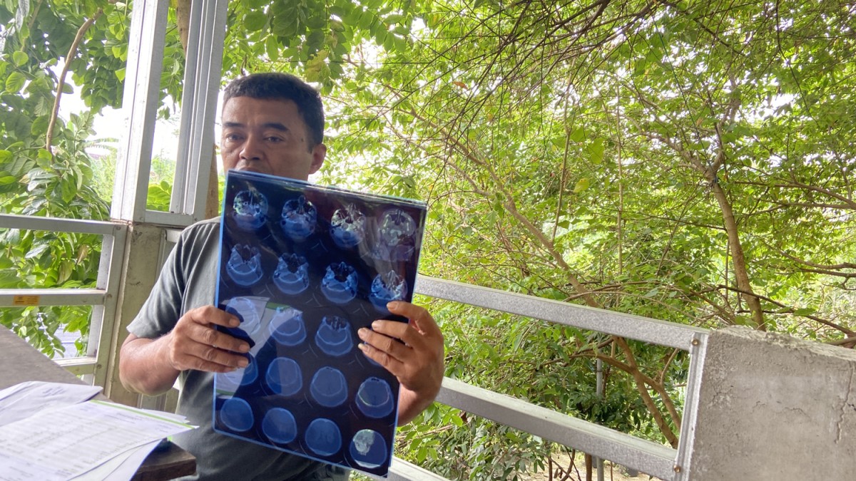 Korban Ipung menunjukkan hasil CT Scan kepala di RS Bhayangkara Kediri. (foto : Yanuar Dedy/jatimnow.com)