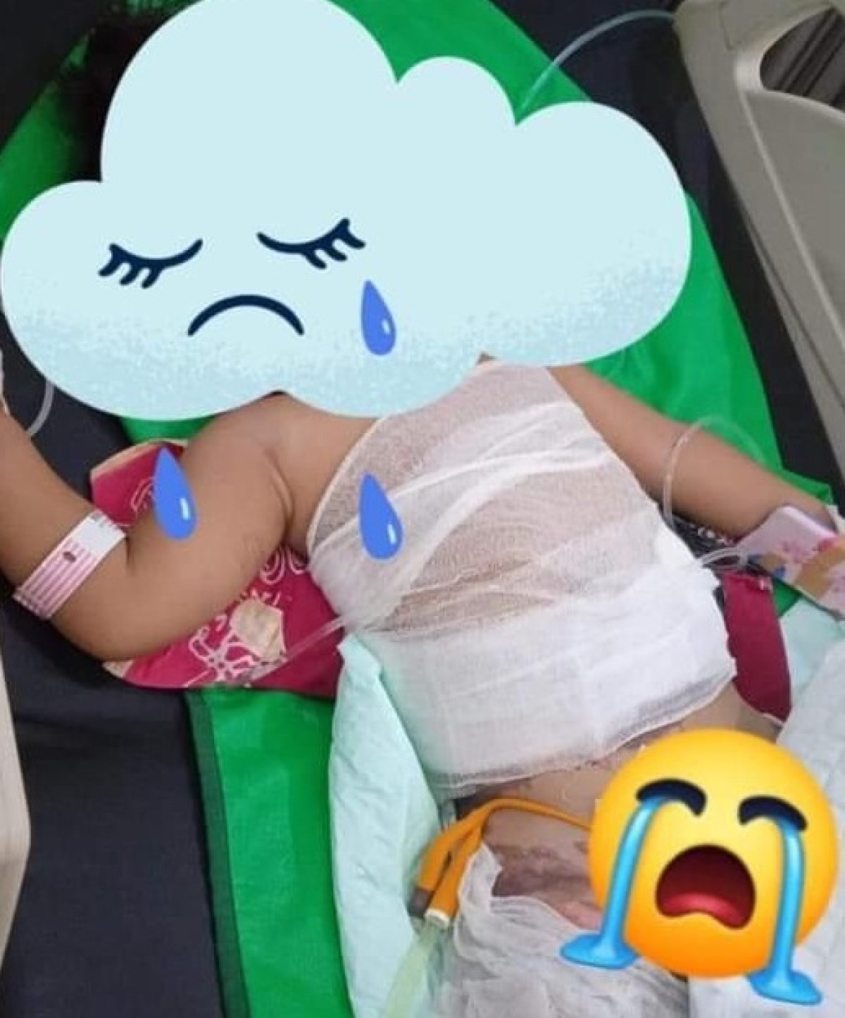 Begini Kisah Dokter IGD RSUD dr Harjono Ponorogo Tangani Anak Tercebur Kuah Panas