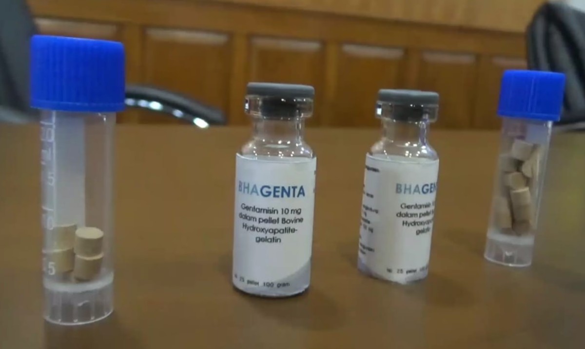 Pakar Farmasi Unair Surabaya Teliti Transplantasi Tulang Sapi untuk Obat Osteoporosis