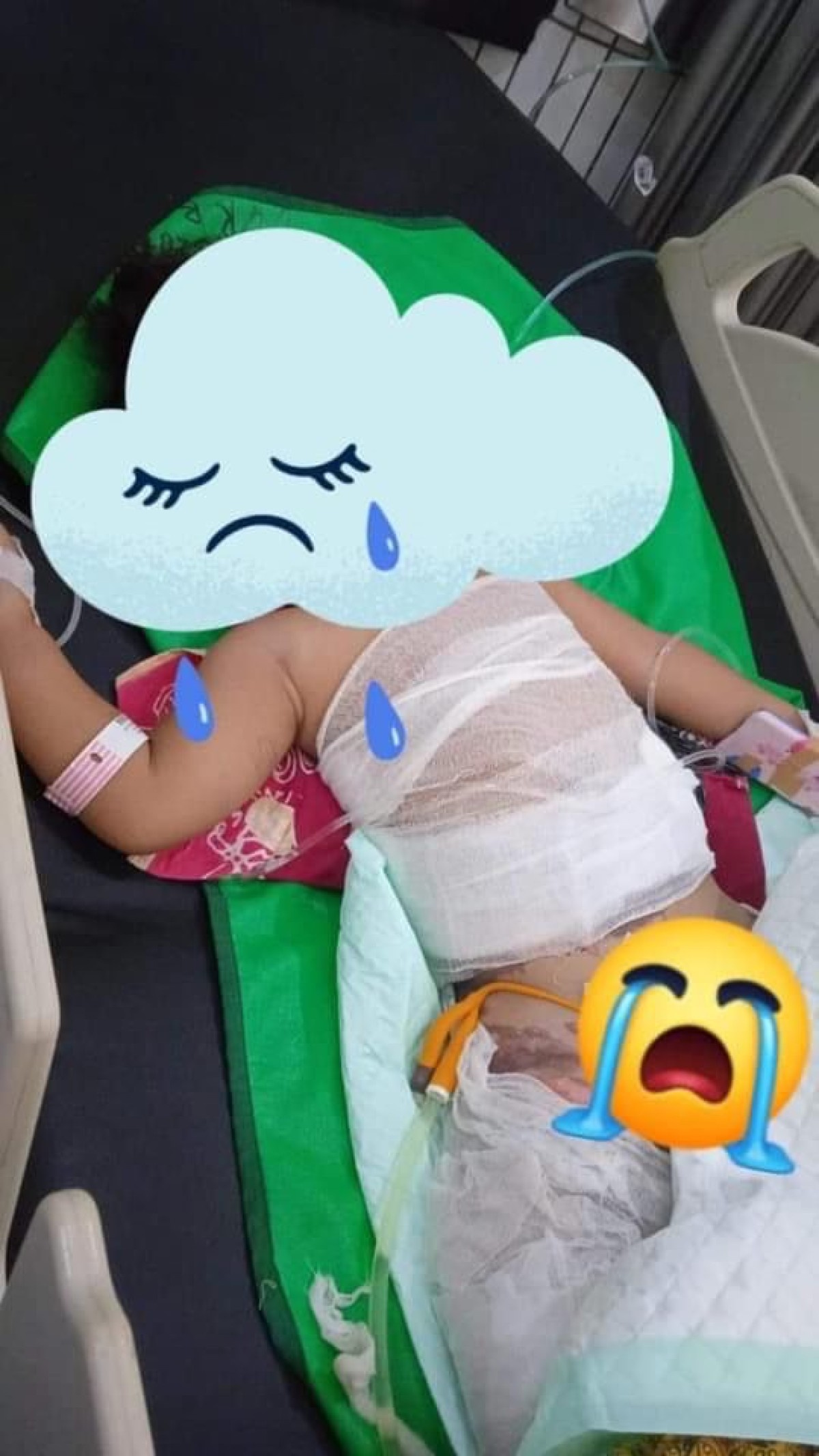 Usai jalani 4 Kali Operasi, Bocah Tercebur Kuah Panas di Ponorogo Meninggal Dunia