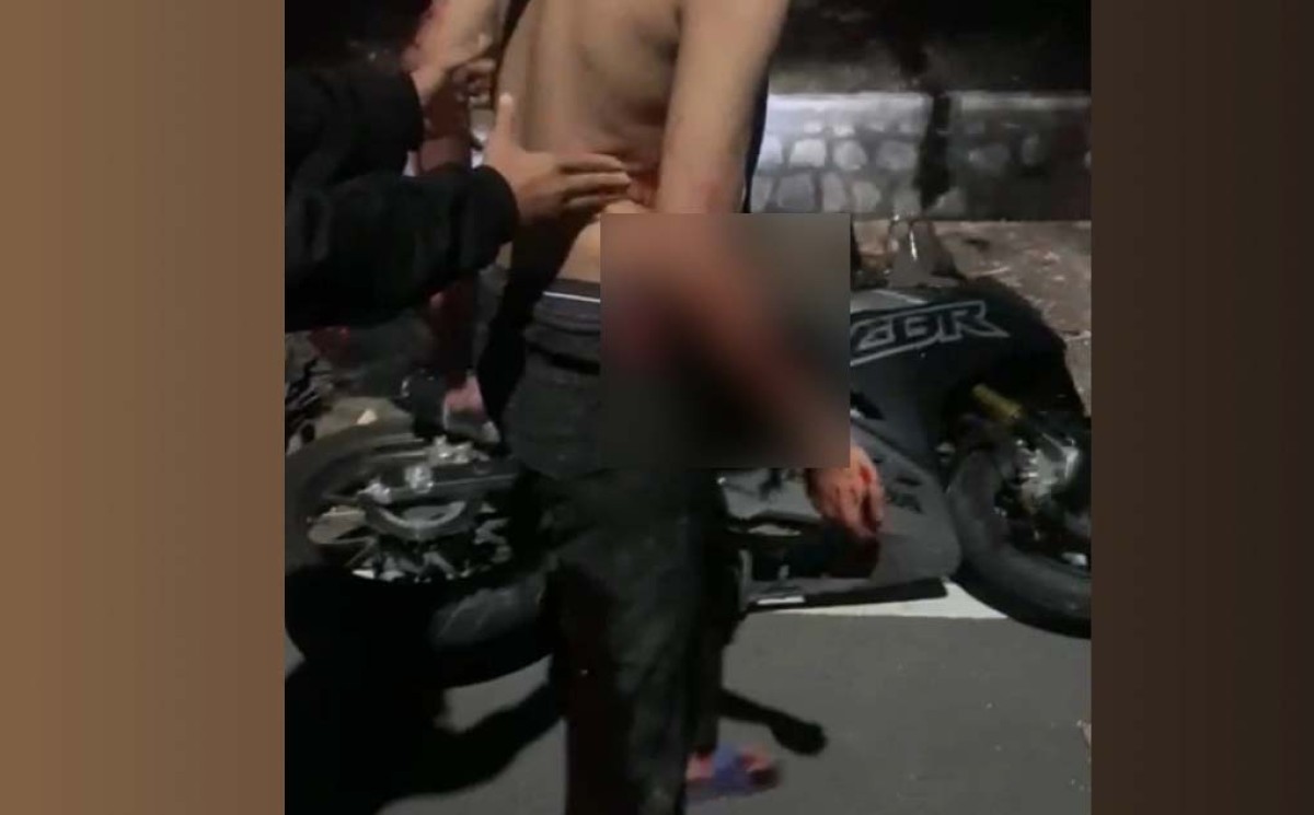 Kondisi korban saat akan diantar oleh pengguna jalan yang melintas untuk mendapatkan perawatan di rumah sakit. (Foto: tangakapan layar)