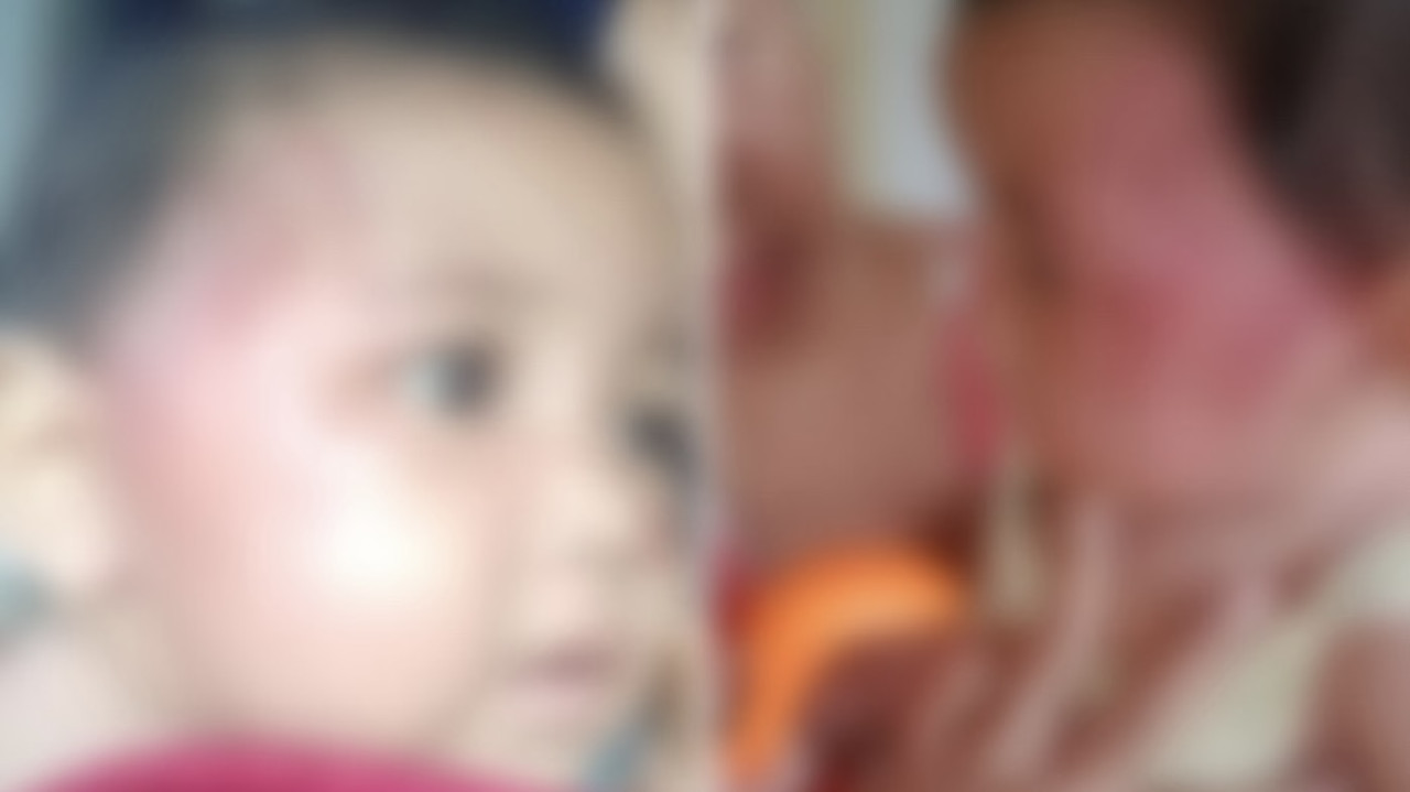 Kondisi balita yang dianiaya ayahnya (Facebook Info Lantas dan Kriminal Probolinggo)