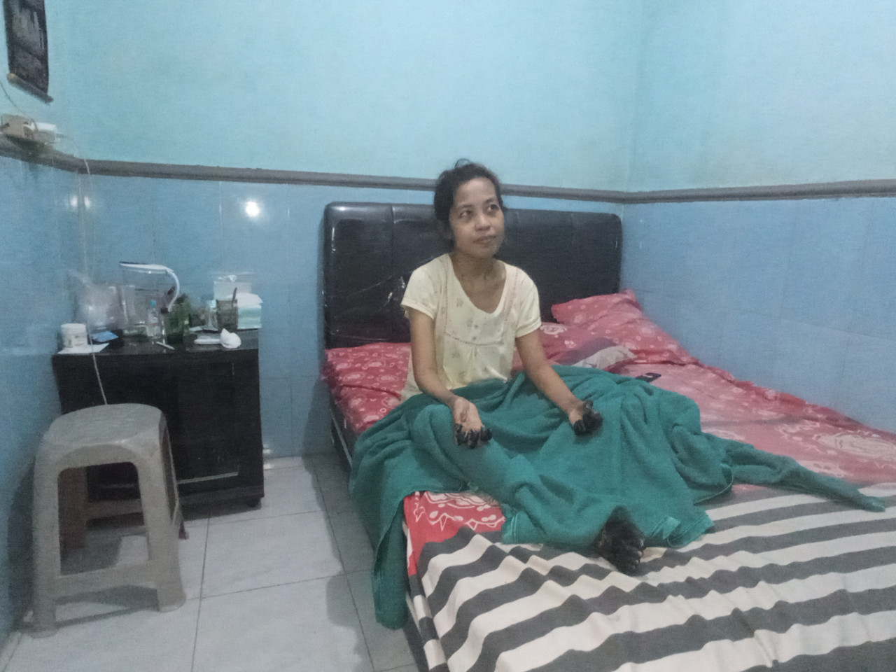 Septia Kurnia Rini, TKW asal Jember alami sakit di Singapura. (Foto: Sugianto/jatimnow.com)