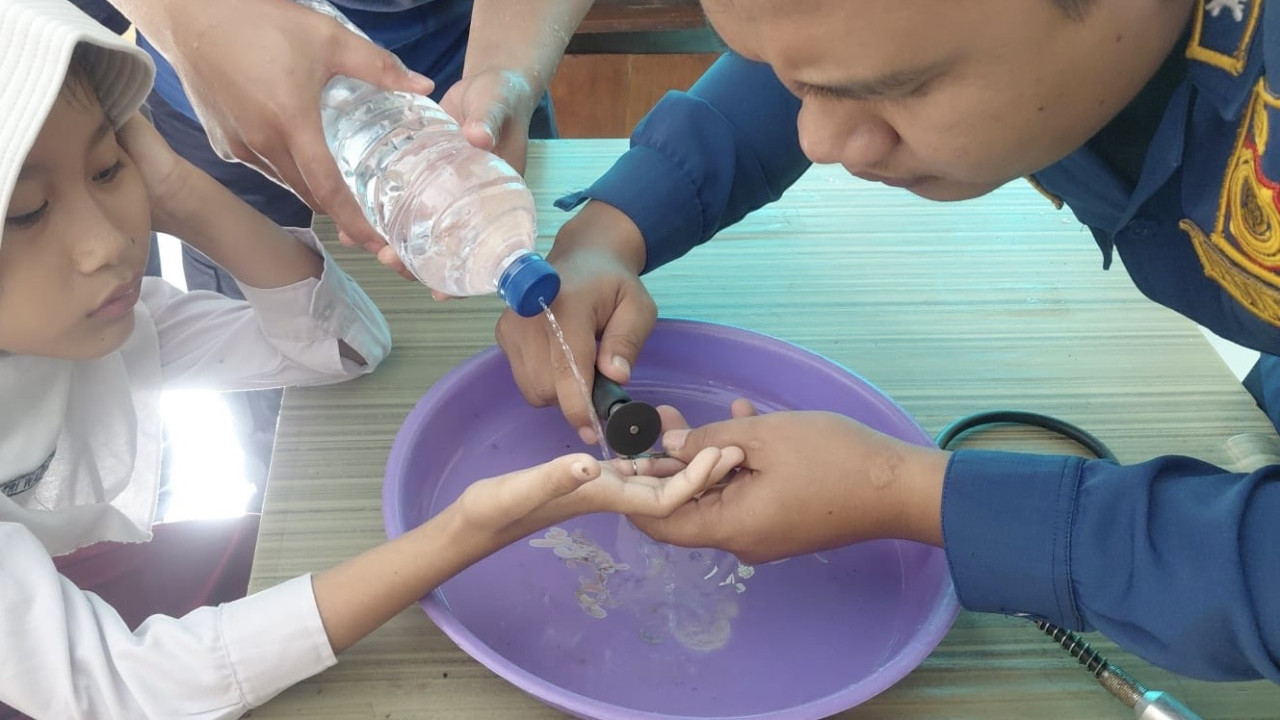 Cincin Mainan Tak Bisa Dilepas, Jari Murid SD di Kediri Bengkak hingga Dievakuasi Damkar