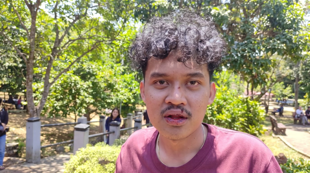 Konferda GMNI Jatim Ricuh, Ketua GMNI Jember Luka di Wajah