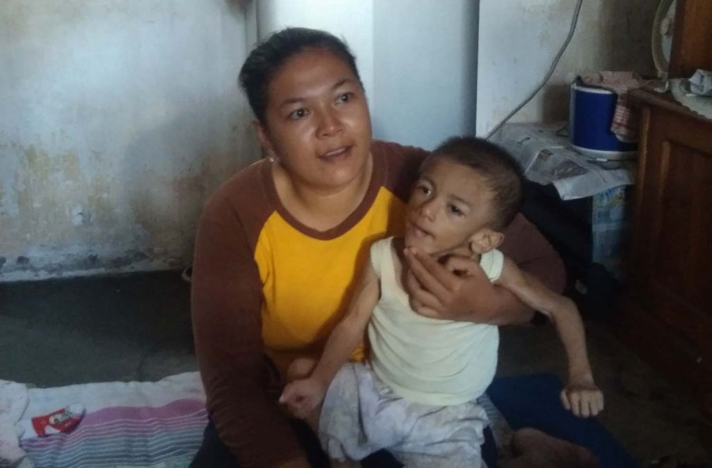 Balita di Kota Probolinggo yang butuh bantuan pengobatan digendong ibunya