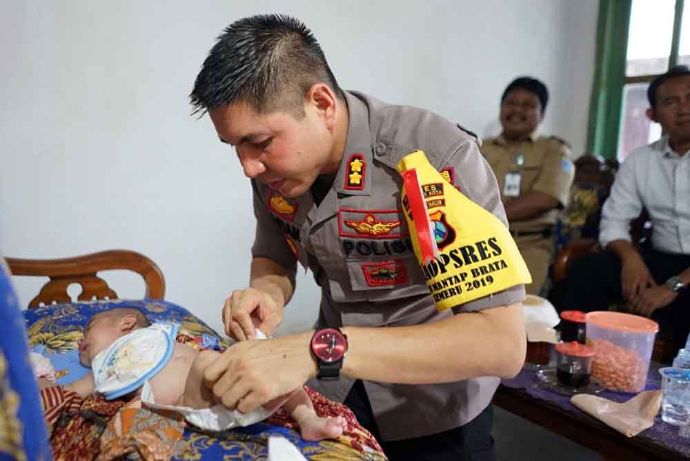 Kapolres Probolinggo Kota AKBP Alfian Nurrizal jenguk bayi tanpa anus
