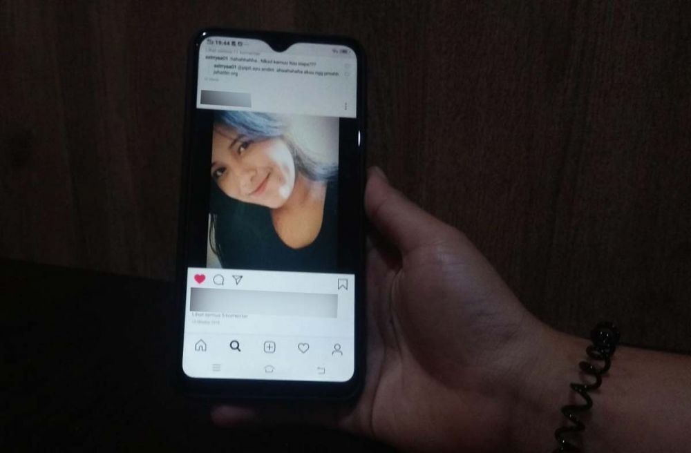 Herlin, Caddy Golf cantik yang mengalami luka akibat dijambret di Surabaya