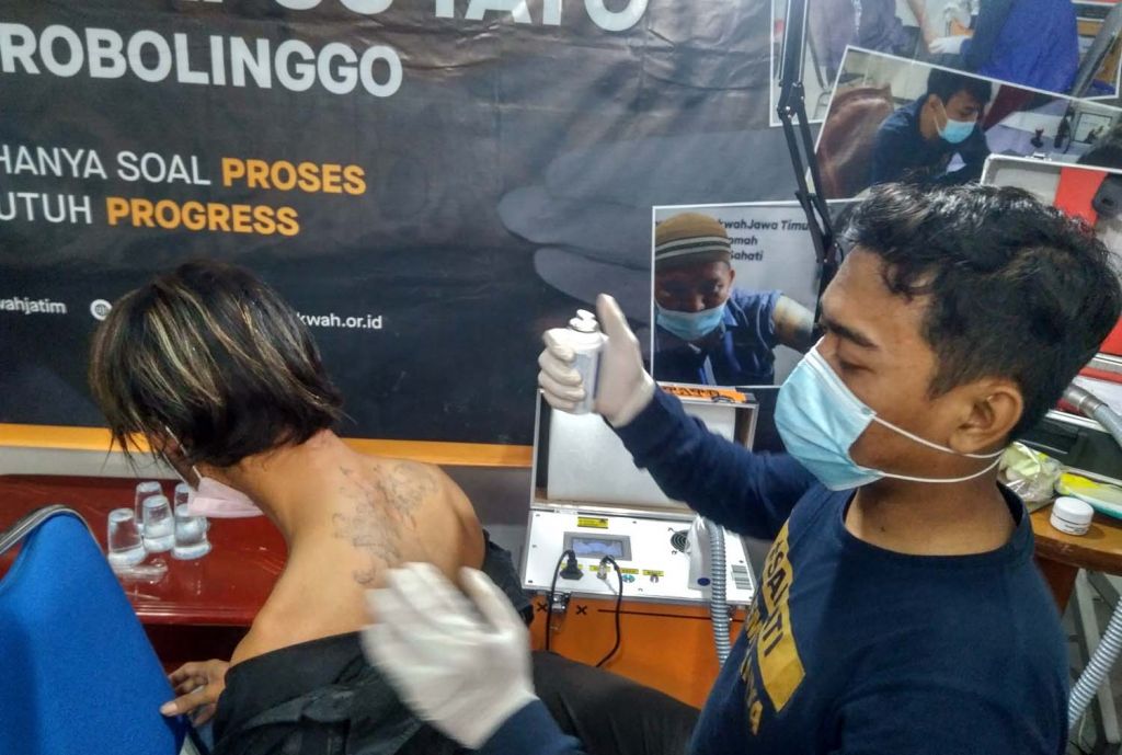 Proses penghapusan tato salah satu peserta