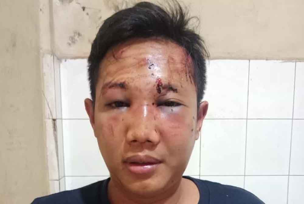 Curi Motor di Surabaya, Pria ini Babak Belur Dimassa