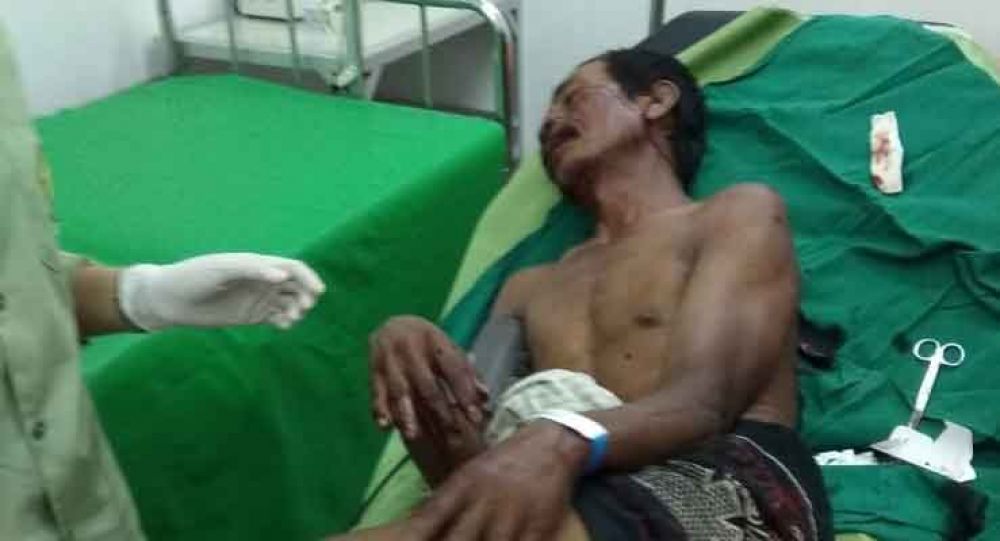 Hanya Karena Sandal Jepit Tertukar, Pria di Probolinggo Dibacok