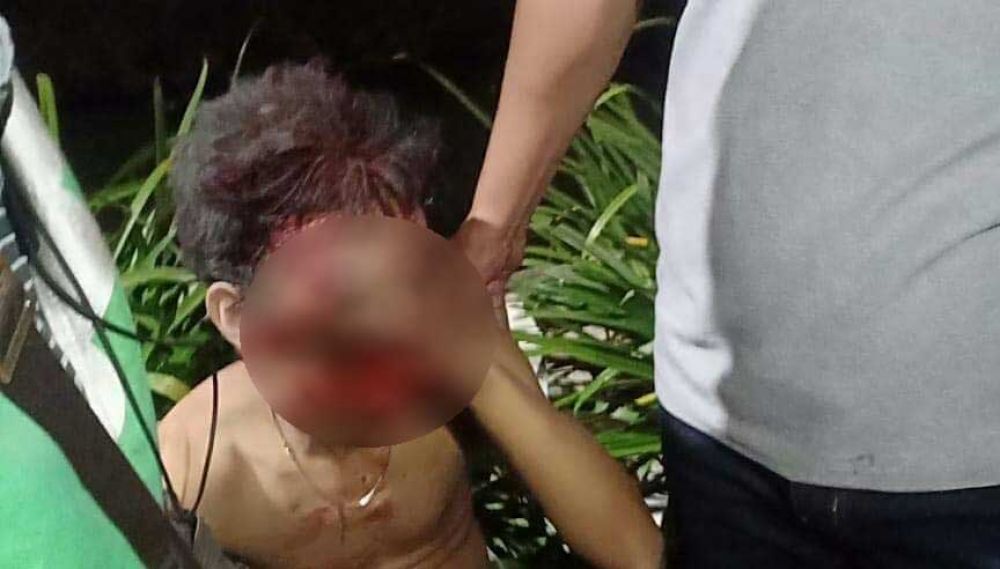 Pelaku babak belur dimassa 