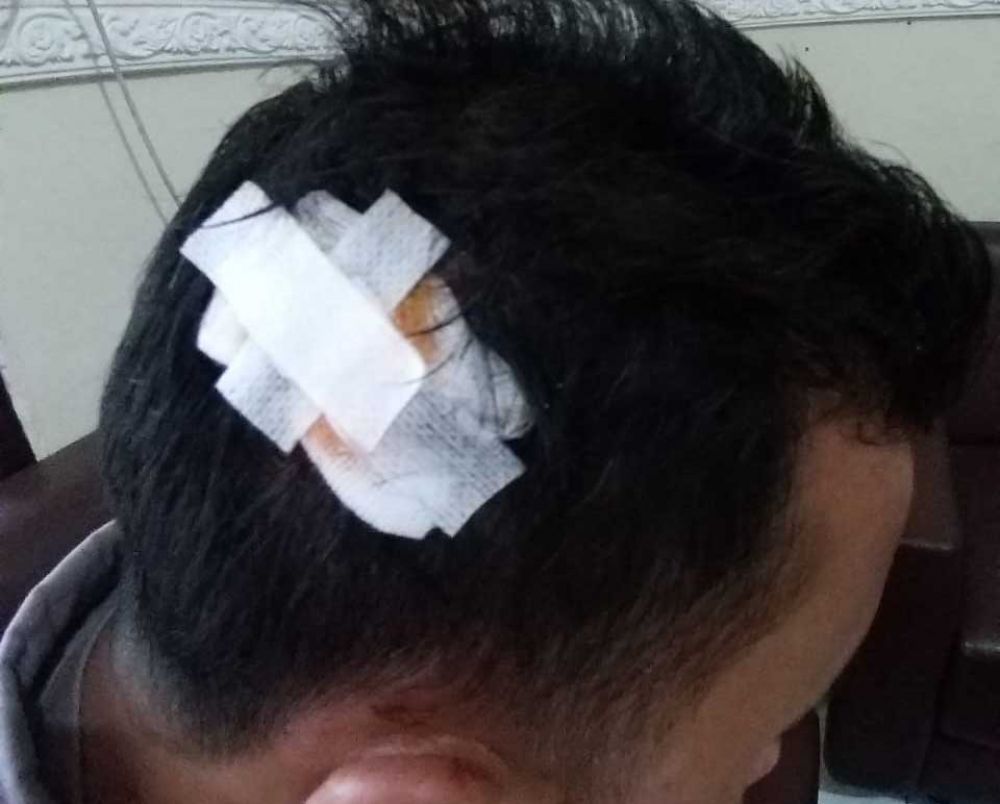 Luka yang diderita Bripka DV