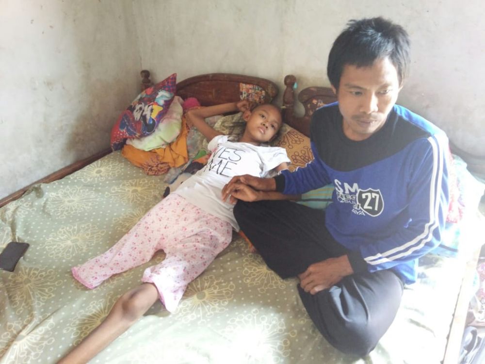 Kaki Siswi SMP yang Derita Kanker Tulang di Mojokerto Telah Diamputasi