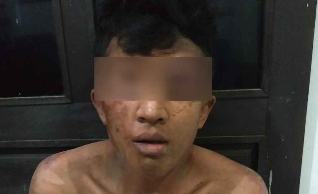 Pelaku pencurian motor yang dihajar massa