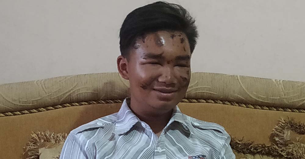 Vicky Mahardika yang tiba dengan selamat di rumahnya di Jalan Cemara Pinus, Kelurahan Sidomulyo, Kecamatan Bumiaji, Kota Batu.