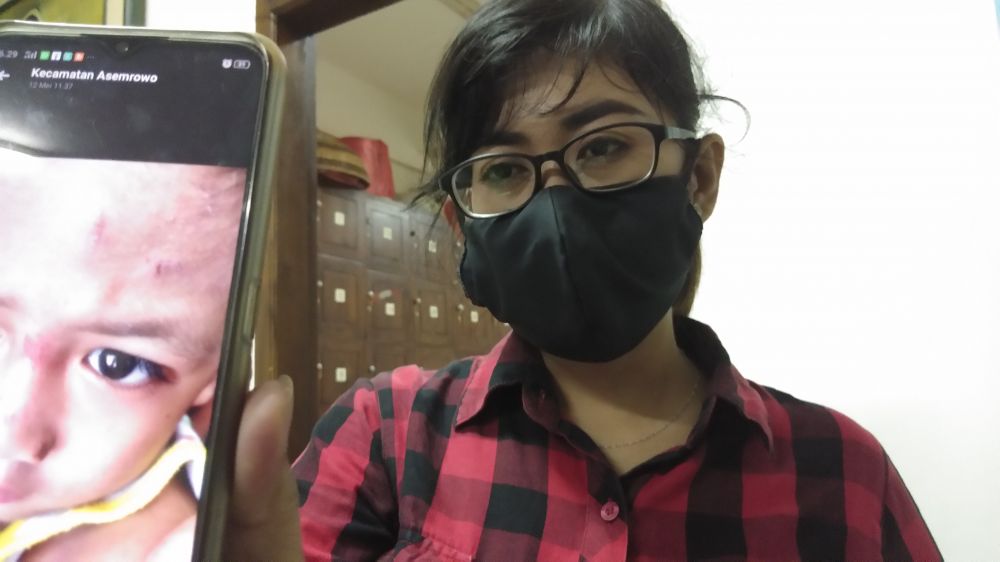 Fainy tunjukkan anaknya yang turut terluka setelah terjatuh dari motor akibat dirinya dijambret