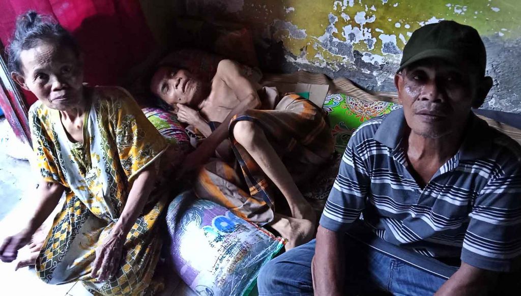 Tiga saudara kandung yang kondisinya memprihatinkan