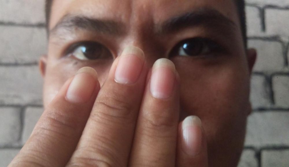 Warna Kuku Kaki Simpan Rahasia Kondisi Kesehatan