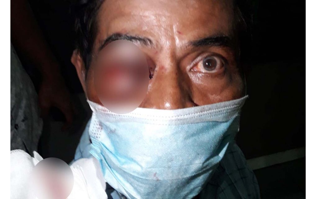 Penggali kubur di Surabaya yang dianiaya temannya sendiri