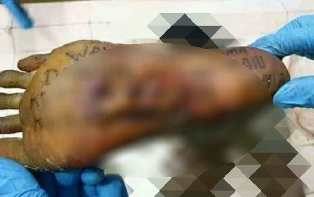 Potongan kaki mayat mutilasi di Pasar Besar Malang