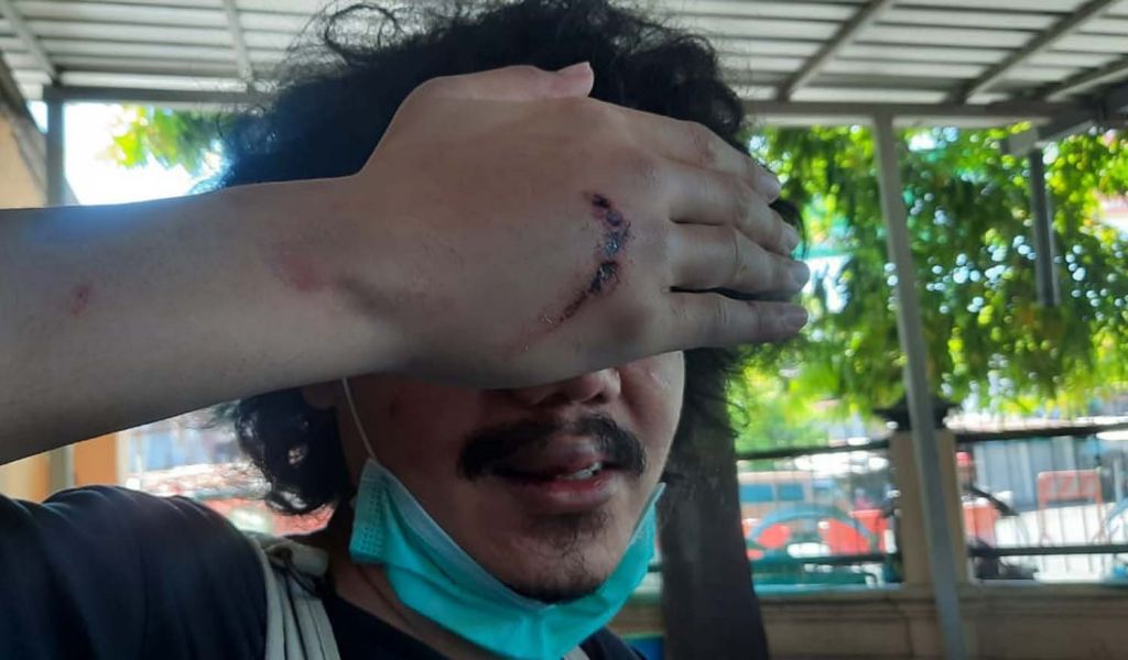 Suki, editor detikcom yang jadi korban komplotan penjahat jalanan di Wonokromo, Surabaya

