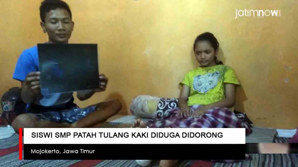Video: Siswi SMP Patah Tulang Kaki Diduga Didorong Temannya