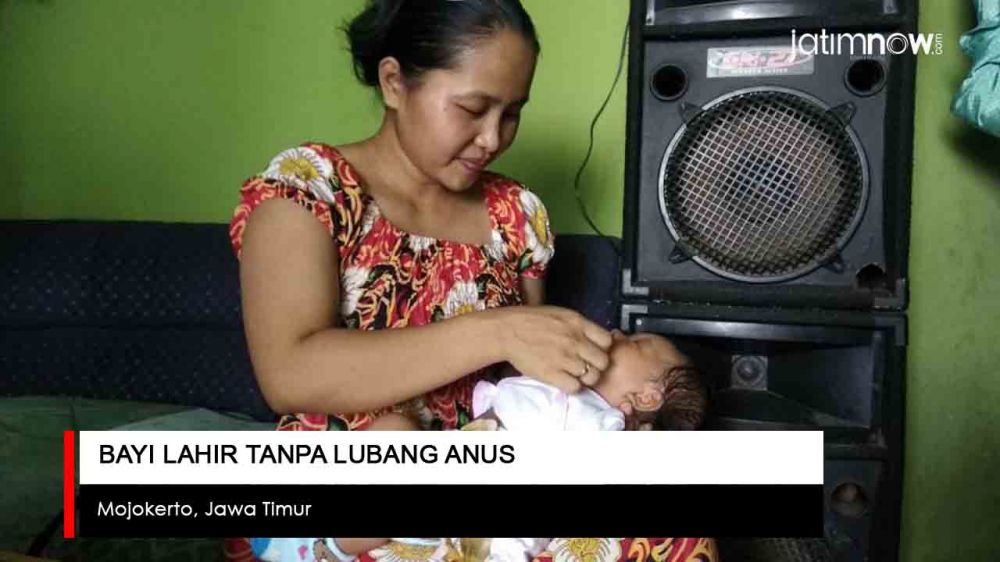 Video: Tolong! Bayi ini Lahir Tanpa Lubang Anus