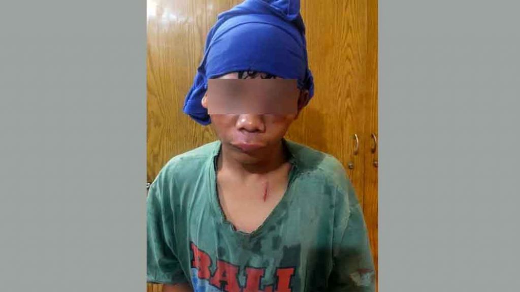 Pencuri motor yang terluka di kepala akibat dihajar massa