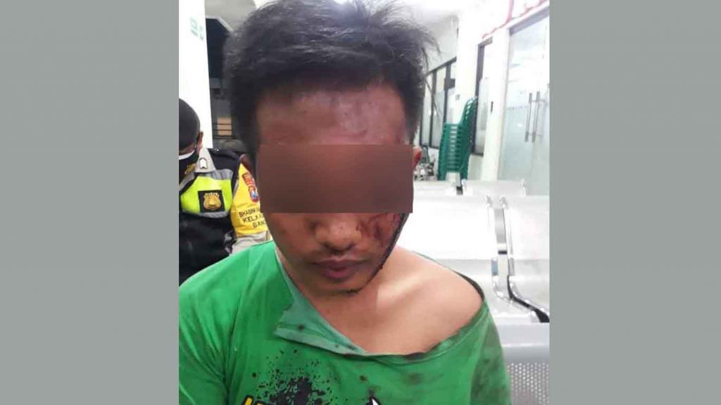 Gigitan Gadis Penjaga Konter Hp di Pasuruan ke Perut Pelaku Gagalkan Perkosaan