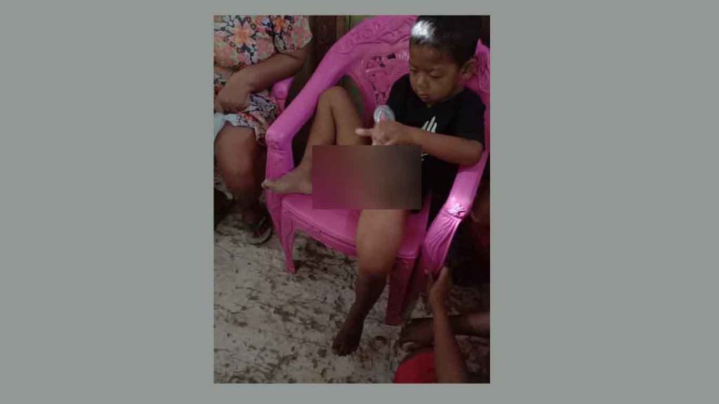 Warga Heboh, Bocah 5 Tahun di Bojonegoro ini Disebut Disunat Jin