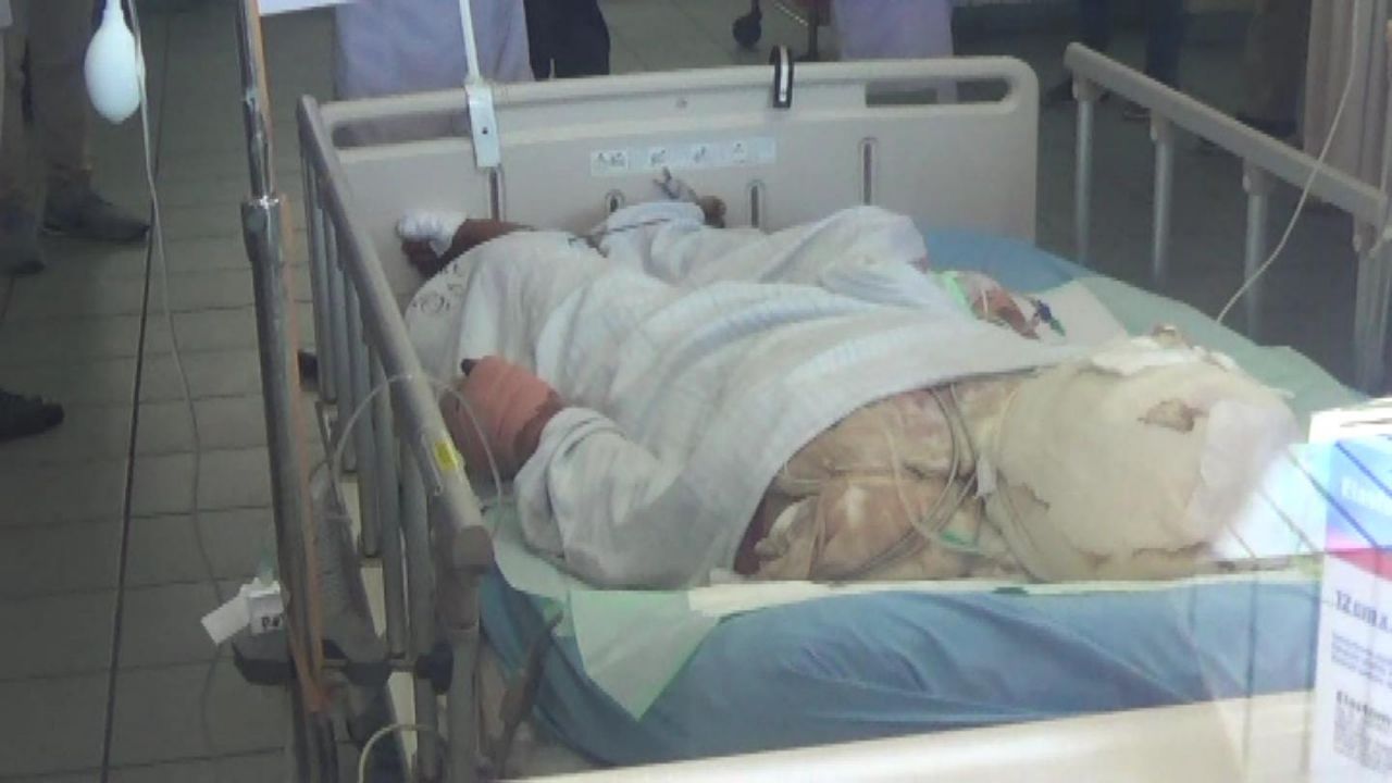 Robi saat masih dirawat di RSU dr Soetomo Surabaya.