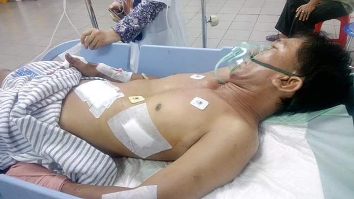  Ikchwan, saat menjalani perawatan di RSU dr Soetomo, Surabaya. 