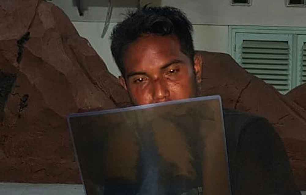 Muslimin saat melihat hasil rontgen tulang rusuknya yang retak